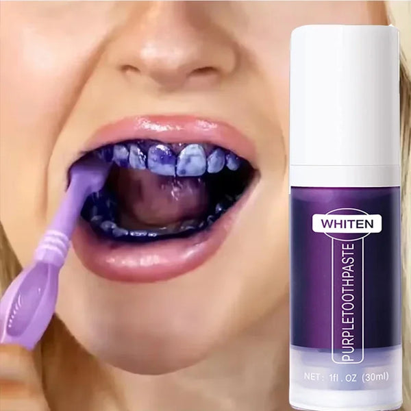 Smile Bright Whitening Foam